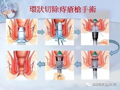 2521562046605858.jpg 5.jpg